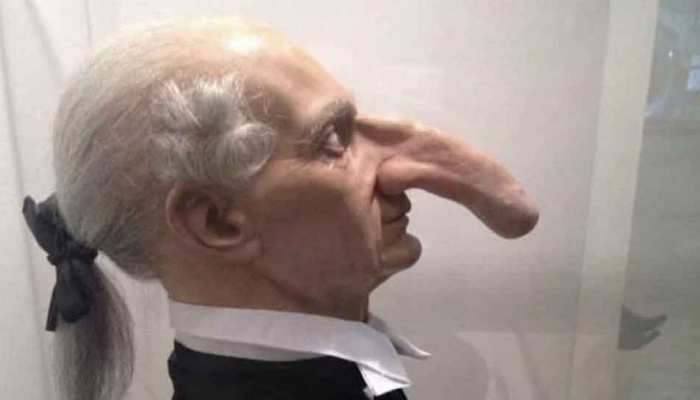 The person with the world's longest nose, do you know its story